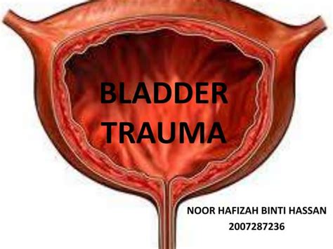 watertight closure bladder trauma